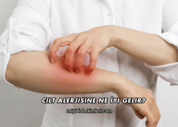 Cilt Alerjisine Ne İyi Gelir?