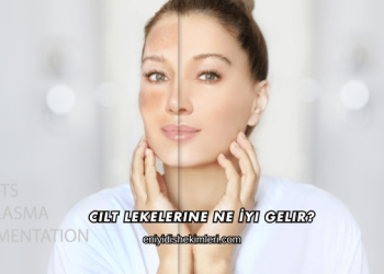 Cilt Lekelerine Ne İyi Gelir?