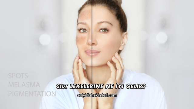 Cilt Lekelerine Ne İyi Gelir?