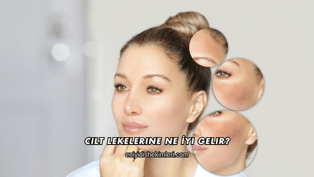 Cilt Lekelerine Ne İyi Gelir?