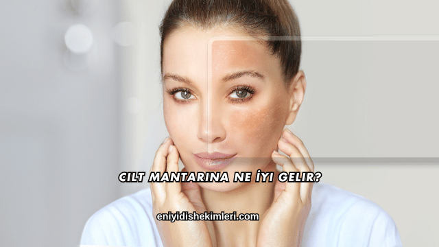 Cilt Mantarına Ne İyi Gelir?