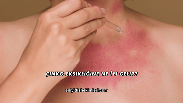 Çinko Eksikliğine Ne İyi Gelir?