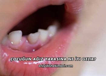 Çocuğun Ağız Yarasına Ne İyi Gelir?