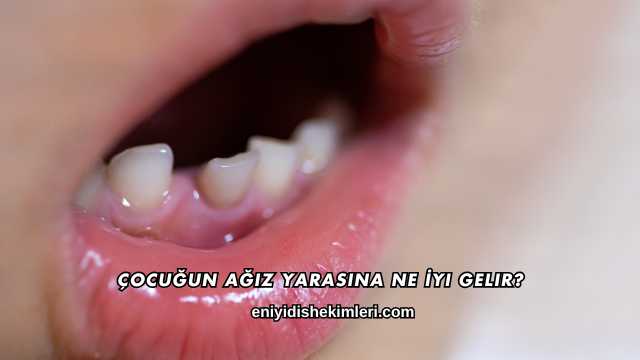 Çocuğun Ağız Yarasına Ne İyi Gelir?