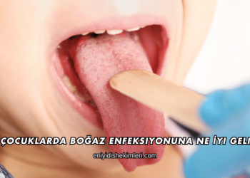 Çocuklarda Boğaz Enfeksiyonuna Ne İyi Gelir