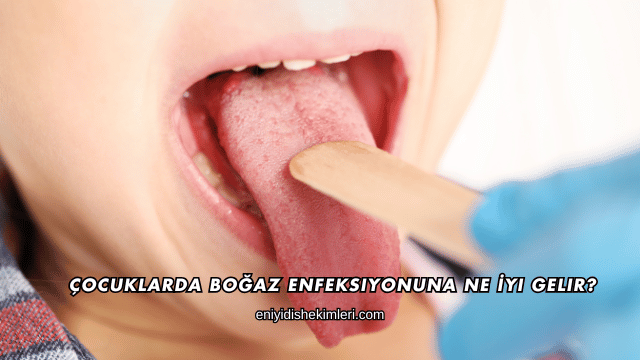 Çocuklarda Boğaz Enfeksiyonuna Ne İyi Gelir