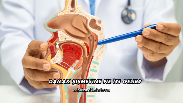 Damak Şişmesine Ne İyi Gelir?
