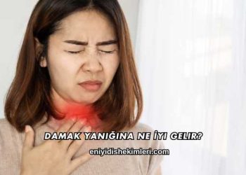Damak Yanığına Ne İyi Gelir?