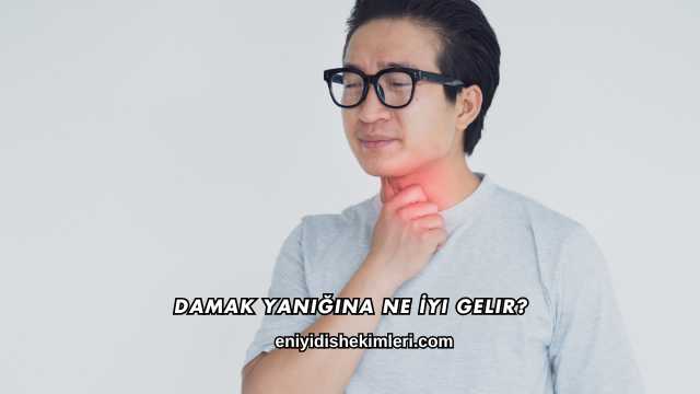 Damak Yanığına Ne İyi Gelir?