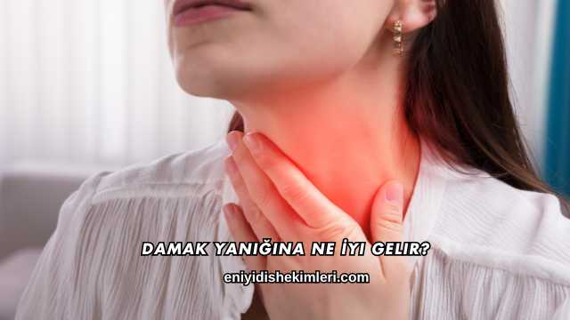 Damak Yanığına Ne İyi Gelir?