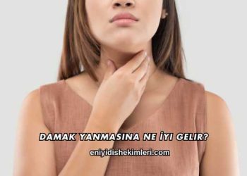 Damak Yanmasına Ne İyi Gelir?