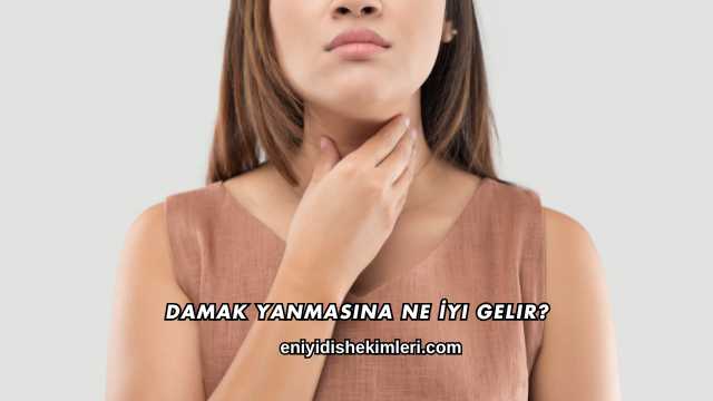Damak Yanmasına Ne İyi Gelir?
