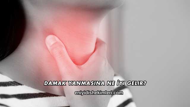Damak Yanmasına Ne İyi Gelir?