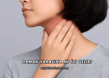 Damak Yarasına Ne İyi Gelir?