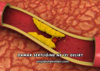 Damar Sertliğine Ne İyi Gelir