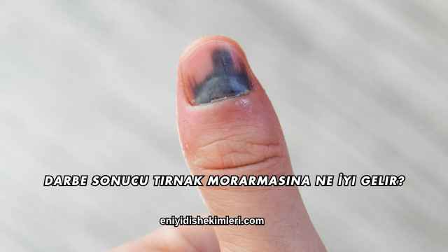 Darbe Sonucu Tırnak Morarmasına Ne İyi Gelir?