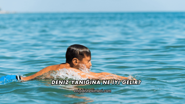 Deniz Yanığına Ne İyi Gelir?