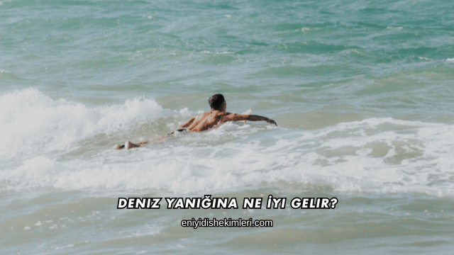 Deniz Yanığına Ne İyi Gelir?