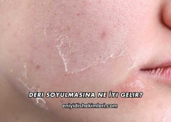 Deri Soyulmasına Ne İyi Gelir?