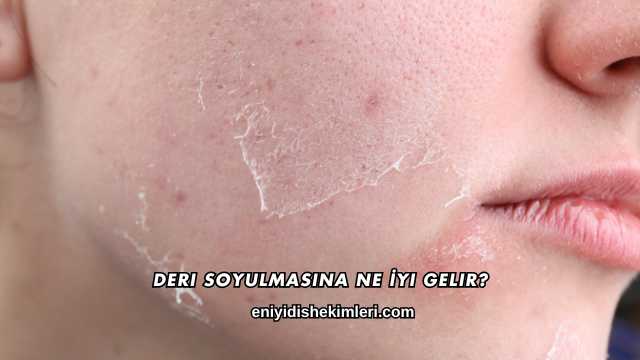 Deri Soyulmasına Ne İyi Gelir?
