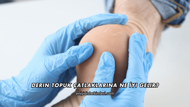Derin Topuk Çatlaklarına Ne İyi Gelir?