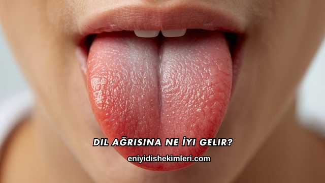 Dil Ağrısına Ne İyi Gelir?