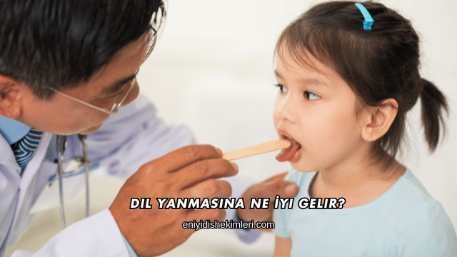Dil Yanmasına Ne İyi Gelir?