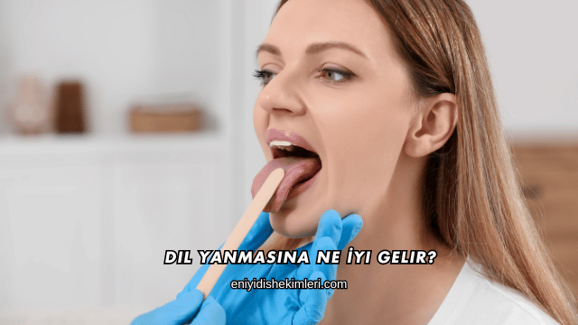 Dil Yanmasına Ne İyi Gelir?