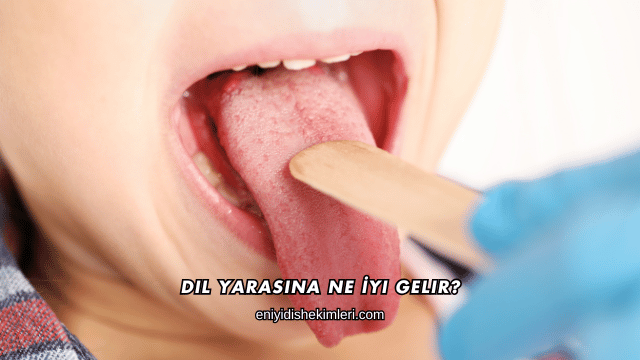 Dil Yarasına Ne İyi Gelir?