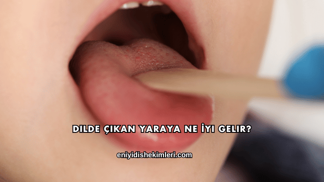 Dilde Çıkan Yaraya Ne İyi Gelir?