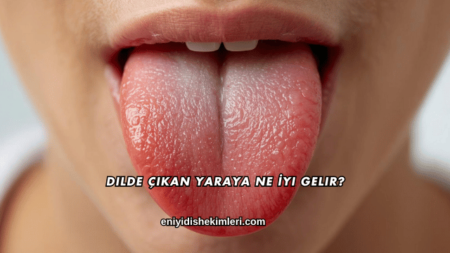 Dilde Çıkan Yaraya Ne İyi Gelir?