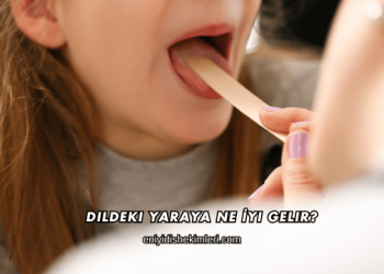 Dildeki Yaraya Ne İyi Gelir?