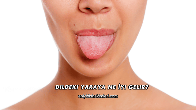 Dildeki Yaraya Ne İyi Gelir?