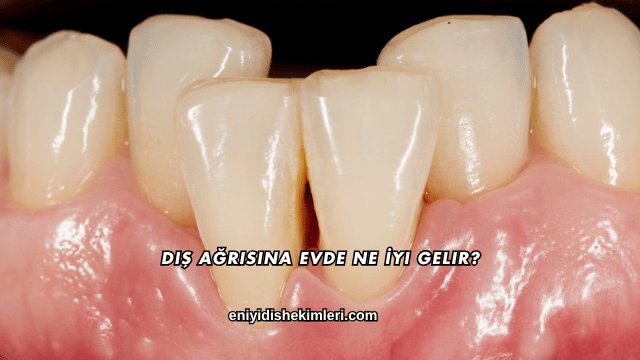 Diş Ağrısına Evde Ne İyi Gelir?