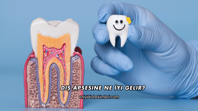 Diş Apsesine Ne İyi Gelir?