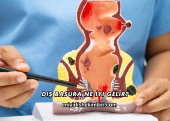 Dış Basura Ne İyi Gelir?
