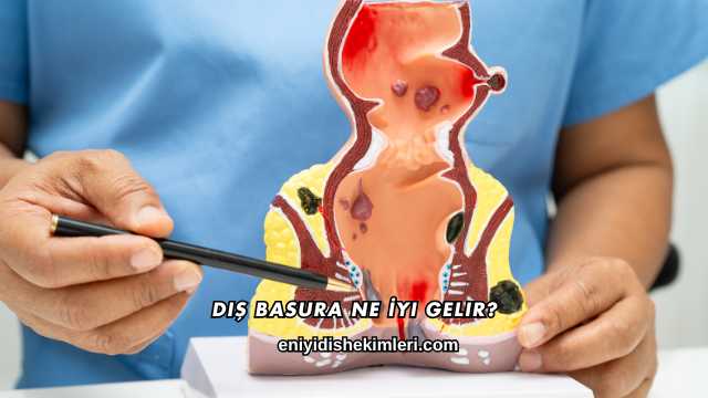 Dış Basura Ne İyi Gelir?