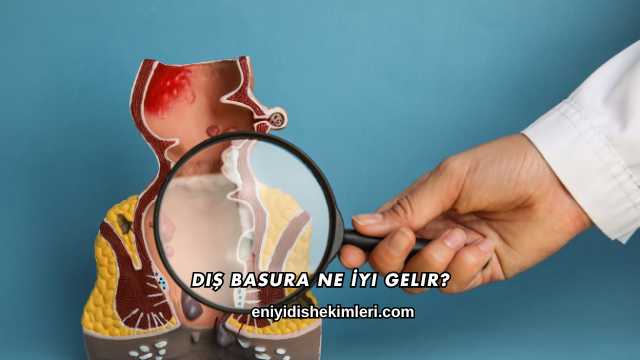 Dış Basura Ne İyi Gelir?