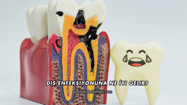 Diş Enfeksiyonuna Ne İyi Gelir?