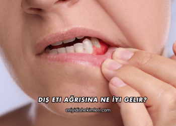 Diş Eti Ağrısına Ne İyi Gelir
