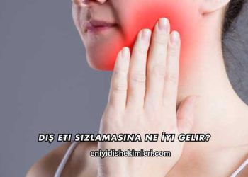 Diş Eti Sızlamasına Ne İyi Gelir?