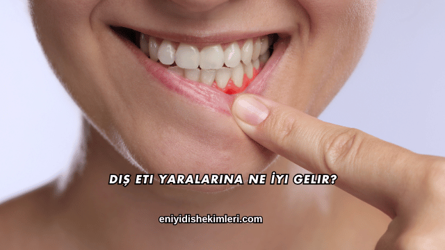 Diş Eti Yaralarına Ne İyi Gelir?