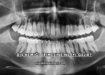 Diş Kemiği Erimesine Ne İyi Gelir?