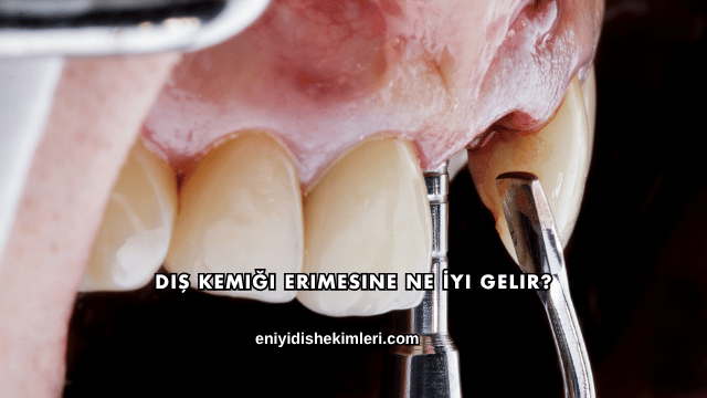 Diş Kemiği Erimesine Ne İyi Gelir?