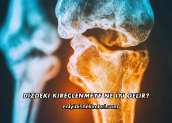 Dizdeki Kireçlenmeye Ne İyi Gelir?