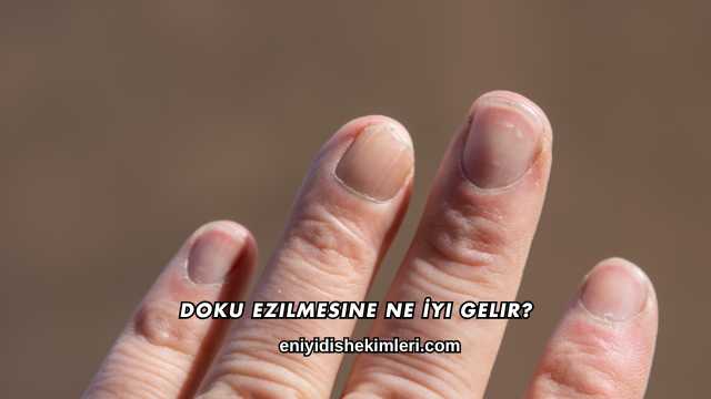 Doku Ezilmesine Ne İyi Gelir?