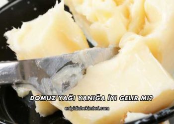Domuz Yağı Yanığa İyi Gelir mi?