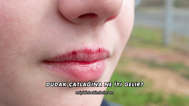 Dudak Çatlağına Ne İyi Gelir?