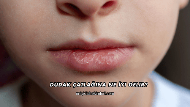 Dudak Çatlağına Ne İyi Gelir?