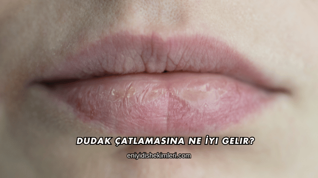 Dudak Çatlamasına Ne İyi Gelir?